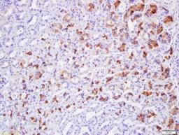 Immunohistochemical staining of mouse stomach tissue using Claudin 19 antibody.