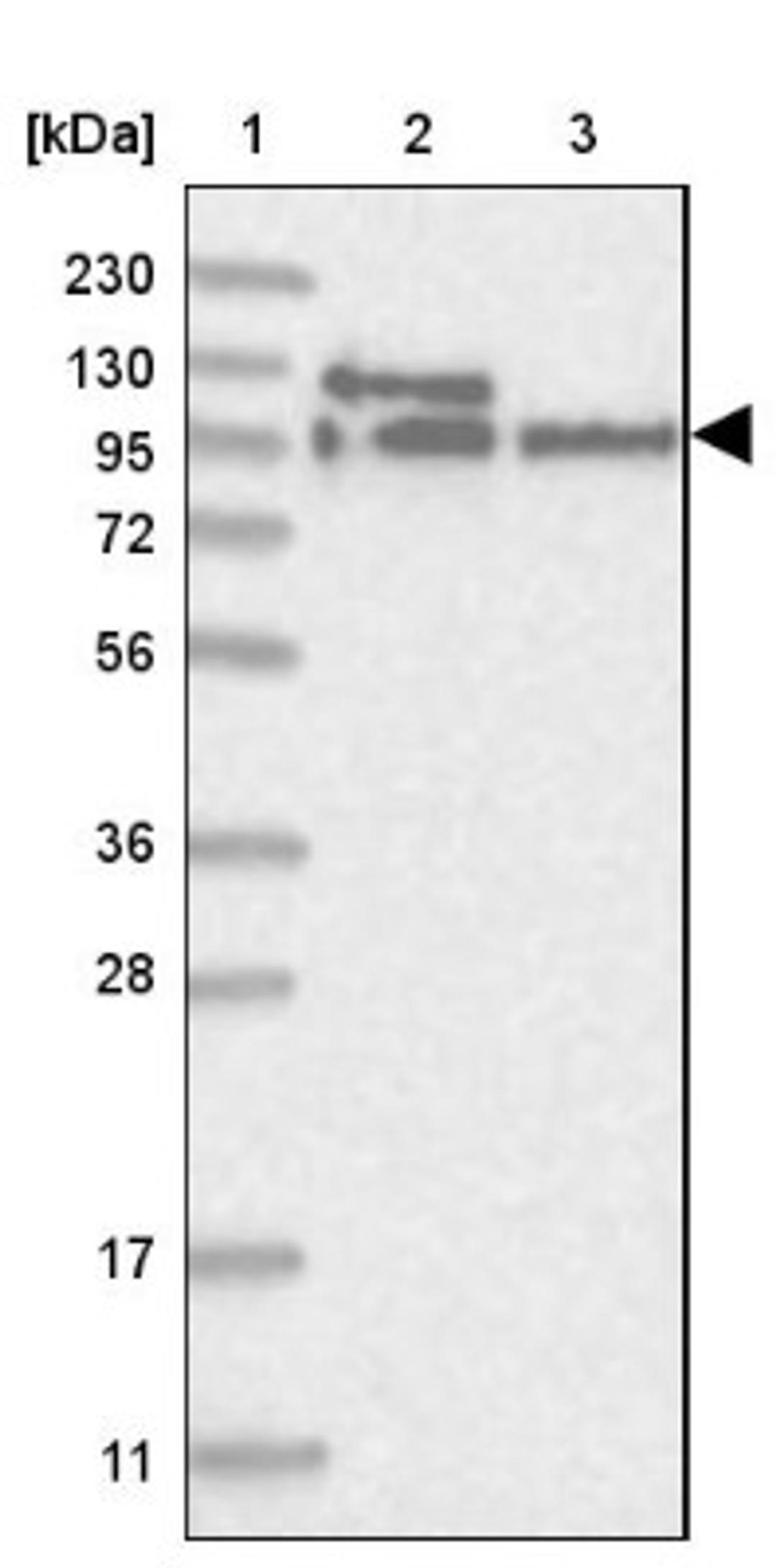 Western Blot: LARP5 Antibody [NBP1-87902] - Lane 1: Marker [kDa] 230, 130, 95, 72, 56, 36, 28, 17, 11<br/>Lane 2: Human cell line RT-4<br/>Lane 3: Human cell line U-251MG sp