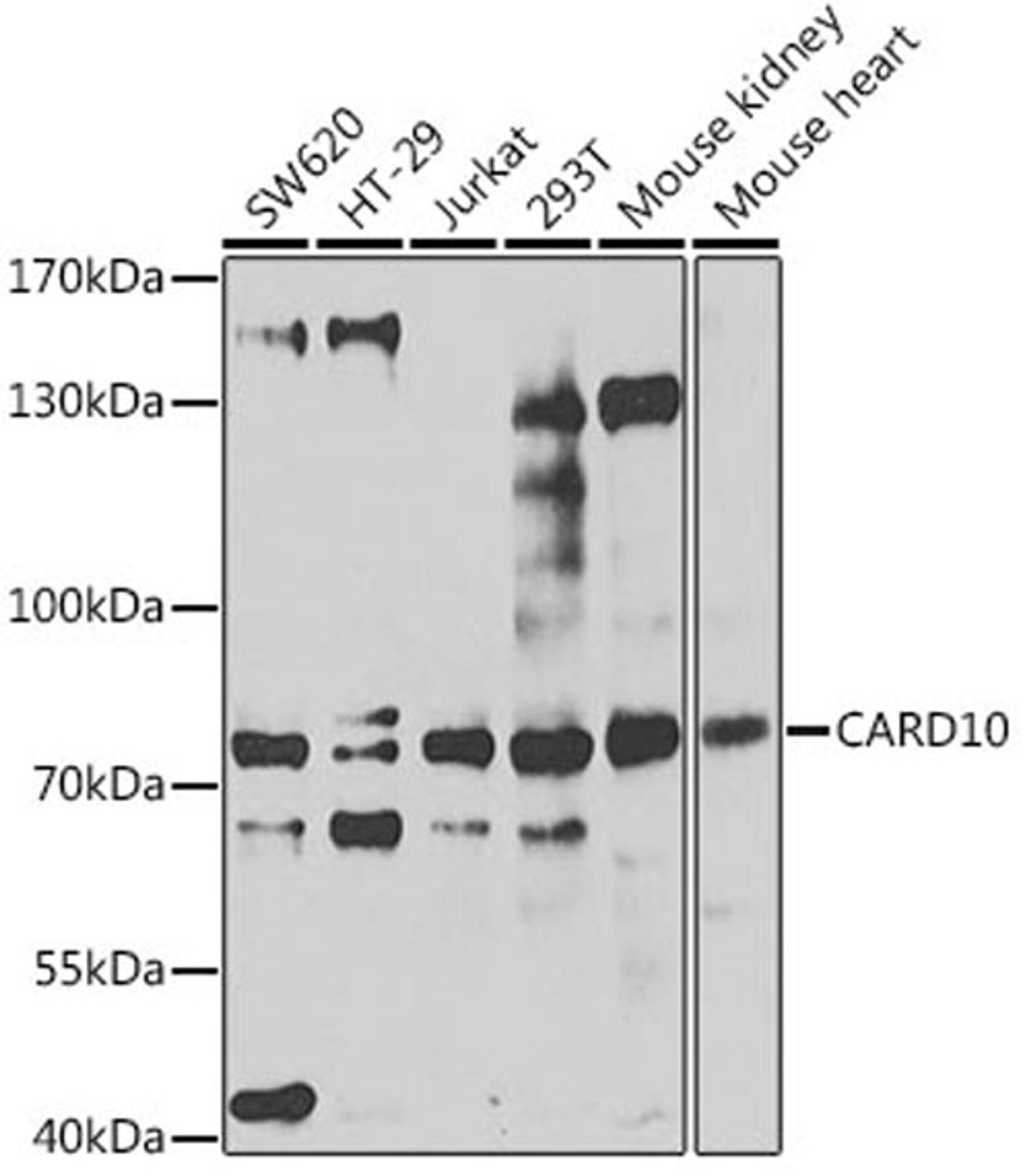 Western blot - CARD10 antibody (A7368)