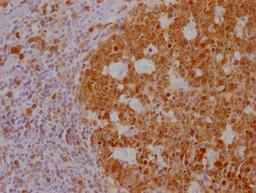 IHC image of CSB-MA181399 diluted at 1:100 and staining in paraffin-embedded human tonsil tissue performed on a Leica BondTM system. After dewaxing and hydration, antigen retrieval was mediated by high pressure in a citrate buffer (pH 6.0). Section was blocked with 10% normal goat serum 30min at RT. Then primary antibody (1% BSA) was incubated at 4°C overnight. The primary is detected by a Goat anti-mouse IgG polymer labeled by HRP and visualized using 0.05% DAB.