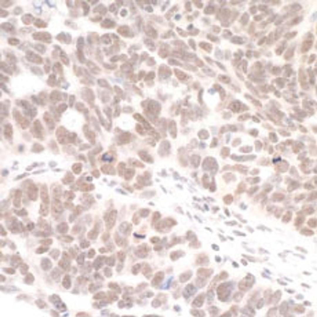 Detection of human DHX8 by immunohistochemistry.