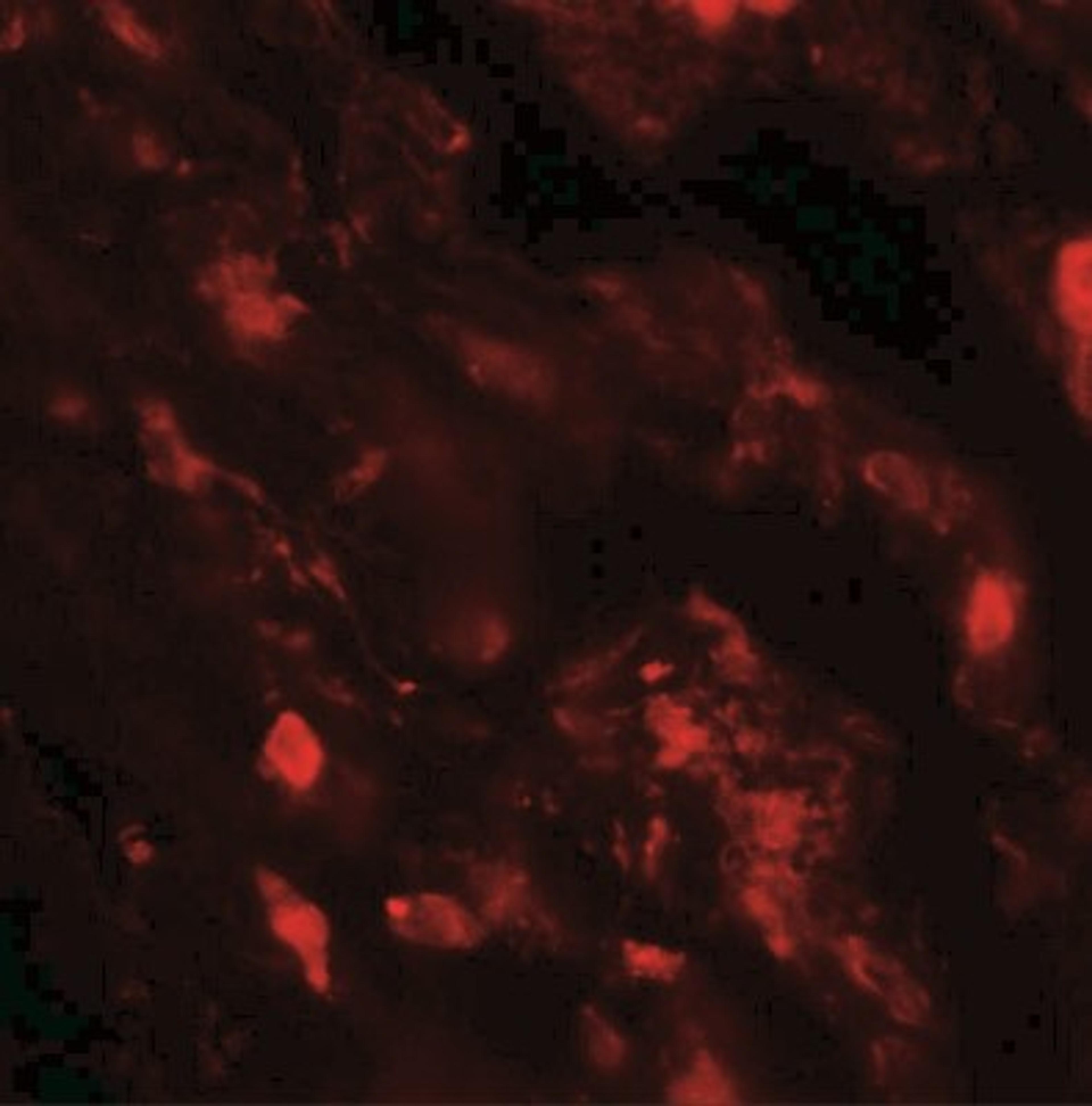 Immunocytochemistry/Immunofluorescence: IL-36 beta/IL-1F8 Antibody [NBP2-41239] - Immunofluorescence of IL-36B in human lung tissue with IL-36B antibody at 20 ug/mL.