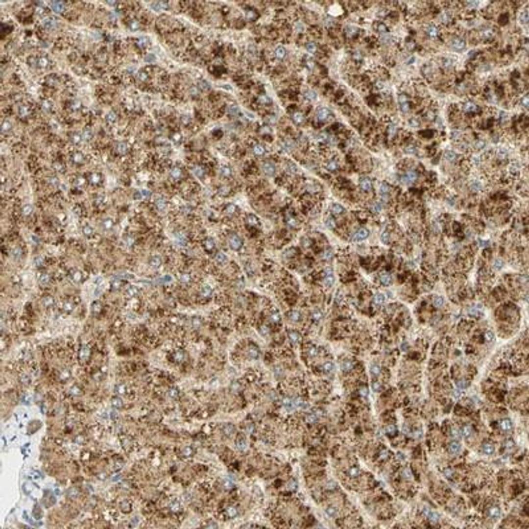 Immunohistochemistry: FAM189A1 Antibody [NBP1-93631] - Immunohistochemical staining of human liver shows strong cytoplasmic positivity in hepatocytes.