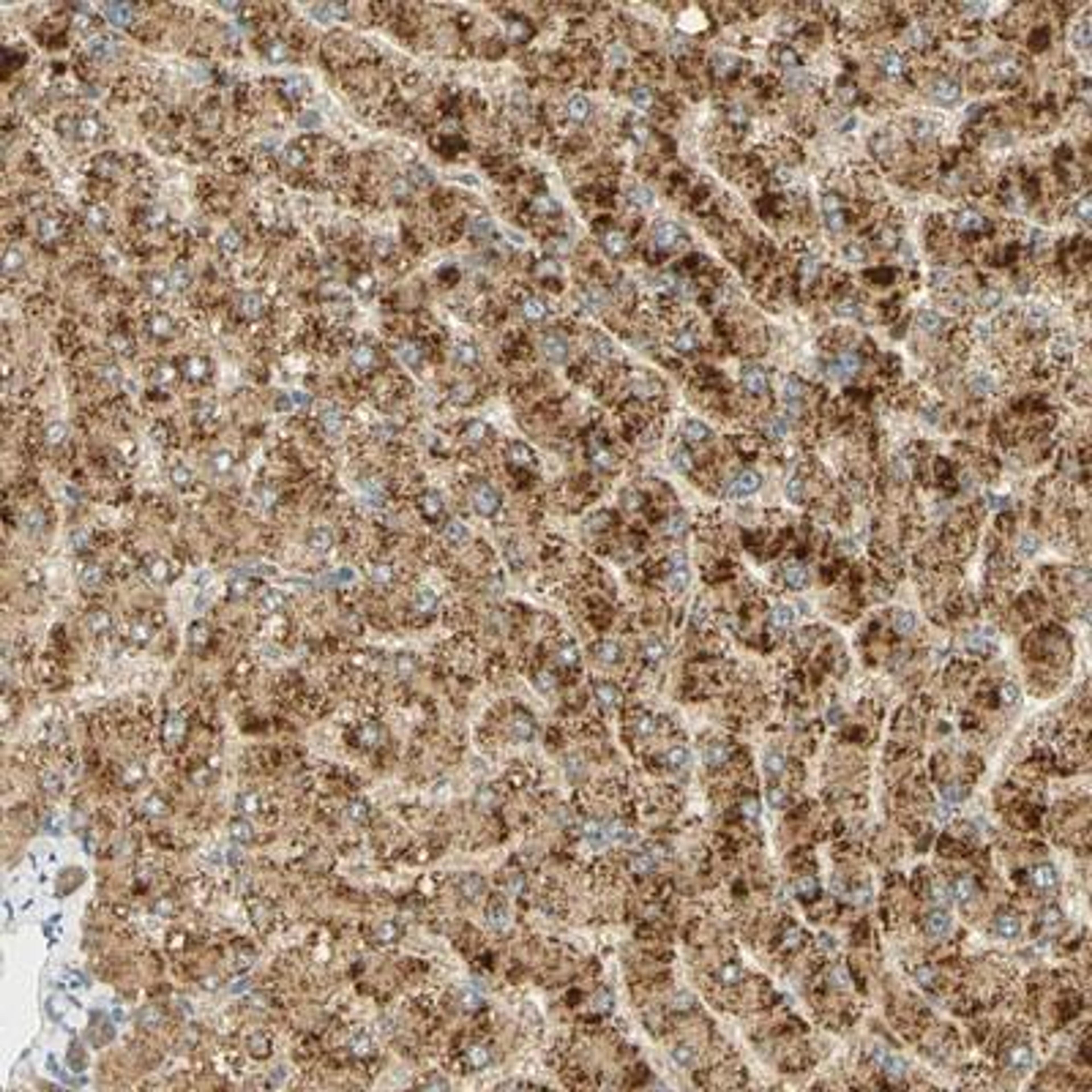 Immunohistochemistry: FAM189A1 Antibody [NBP1-93631] - Immunohistochemical staining of human liver shows strong cytoplasmic positivity in hepatocytes.