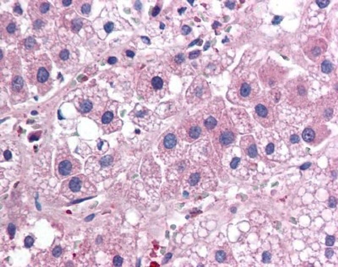 Immunohistochemistry: IL17E Antibody (68C1039.2) [NB100-56541] - Adrenal cortex, Human: Formalin-Fixed Paraffin-Embedded (FFPE)