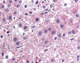 Immunohistochemistry: IL17E Antibody (68C1039.2) [NB100-56541] - Adrenal cortex, Human: Formalin-Fixed Paraffin-Embedded (FFPE)