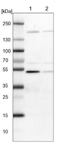 Western Blot: BYSL Antibody [NBP1-89501] - Lane 1: NIH-3T3 cell lysate (Mouse embryonic fibroblast cells)<br/>Lane 2: NBT-II cell lysate (Rat Wistar bladder tumour cells)