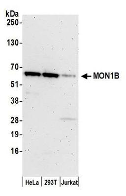 Detection of human MON1B by WB.