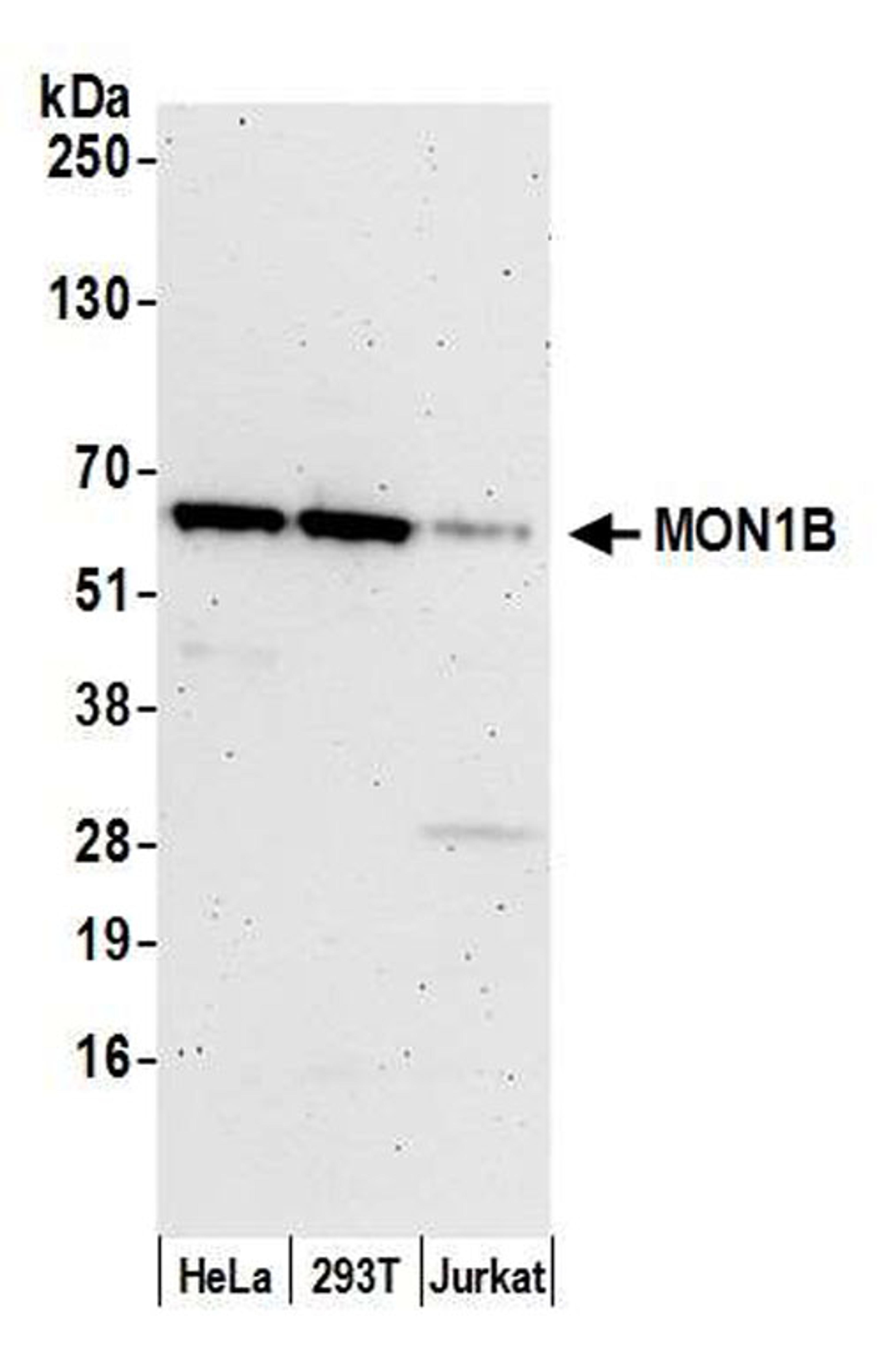 Detection of human MON1B by WB.