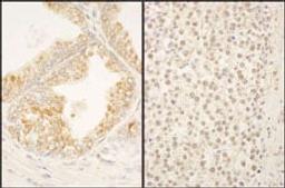 Detection of human FBXO38 by immunohistochemistry.