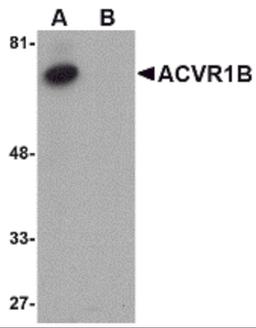 Western blot analysis of ACVR1B in human kidney tissue lysate with ACVR1B antibody at 1 μg/mL in (A) the absence and (B) the presence of blocking peptide.