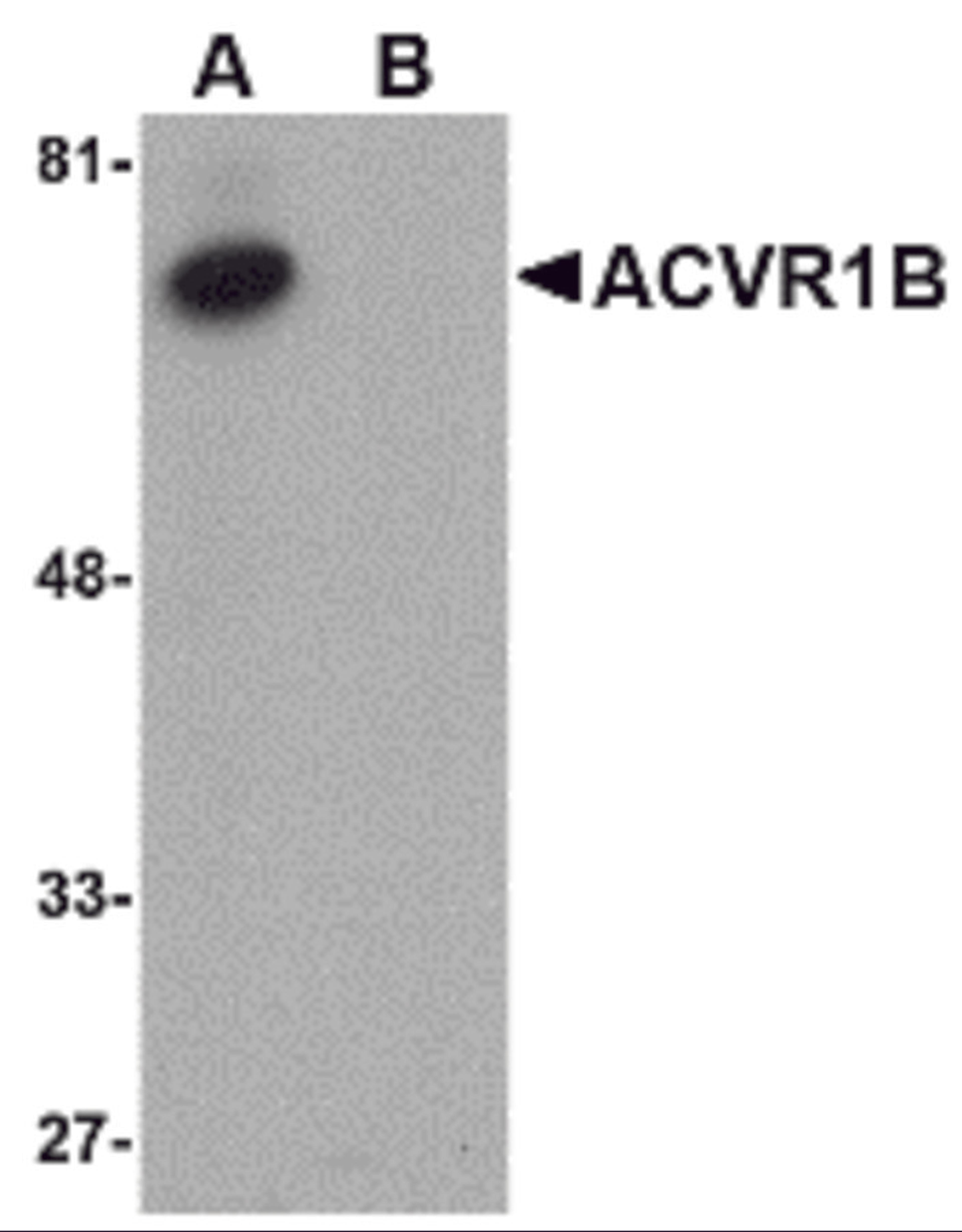 Western blot analysis of ACVR1B in human kidney tissue lysate with ACVR1B antibody at 1 μg/mL in (A) the absence and (B) the presence of blocking peptide.
