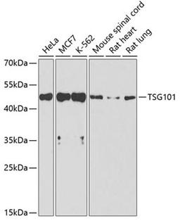 Western blot - TSG101 antibody (A1692)