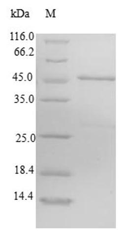 (Tris-Glycine gel) Discontinuous SDS-PAGE (reduced) with 5% enrichment gel and 15% separation gel.