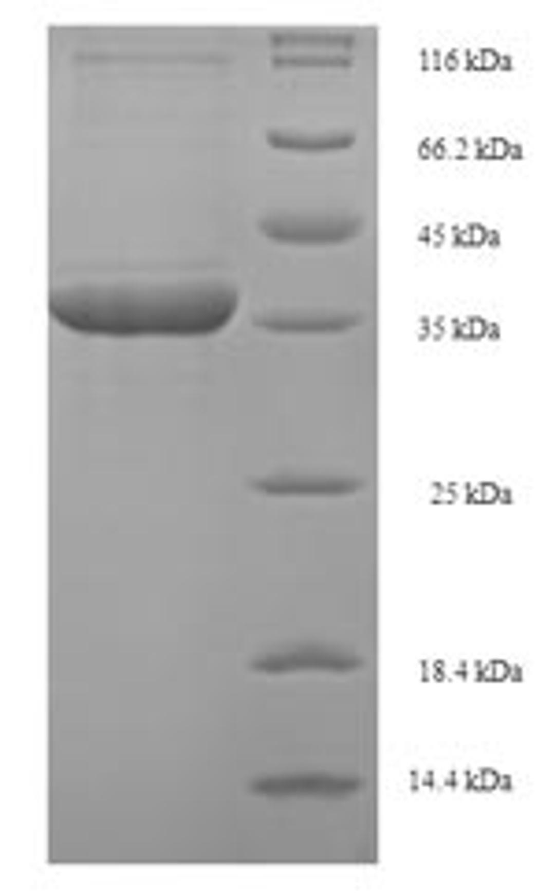 (Tris-Glycine gel) Discontinuous SDS-PAGE (reduced) with 5% enrichment gel and 15% separation gel.