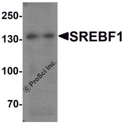 Western blot analysis of SREBF1 in Daudi cell lysate with SREBF1 antibody at 1 μg/ml.
