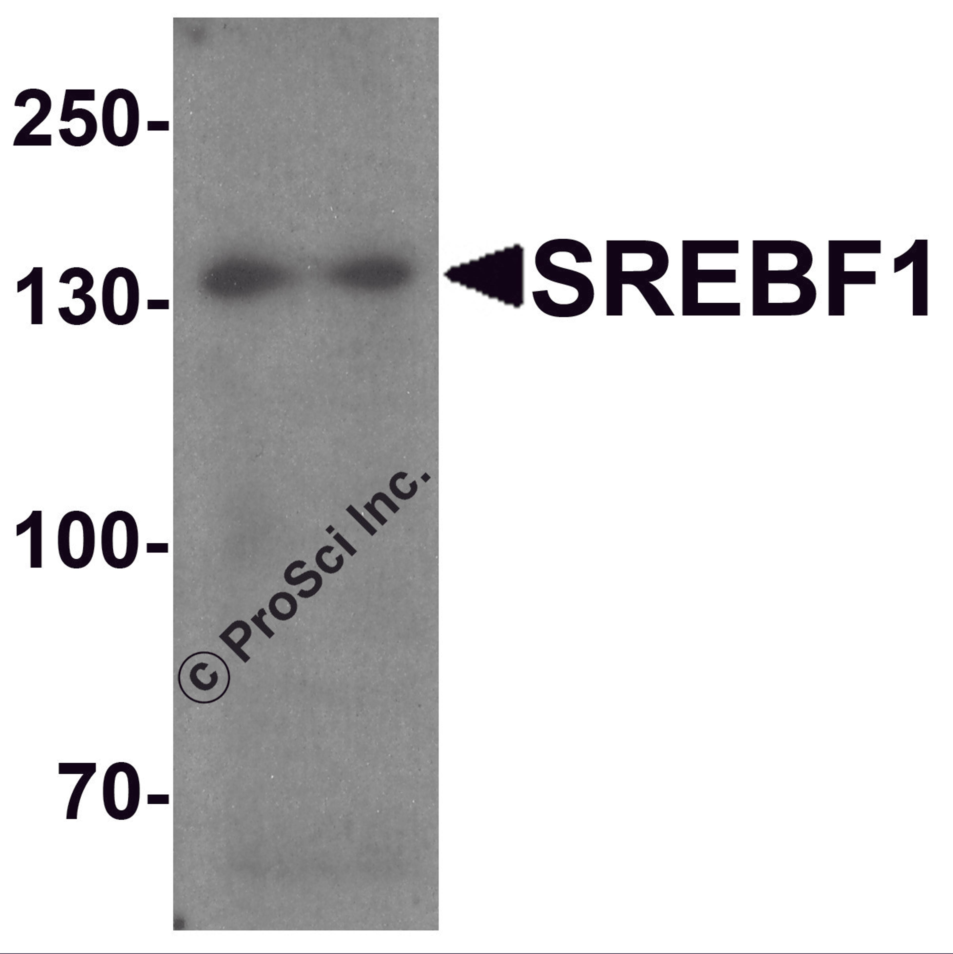 Western blot analysis of SREBF1 in Daudi cell lysate with SREBF1 antibody at 1 μg/ml.