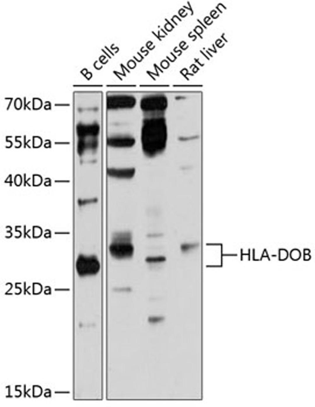 Western blot - HLA-DOB antibody (A12152)