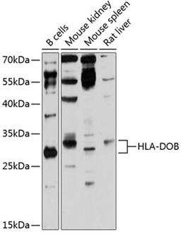 Western blot - HLA-DOB antibody (A12152)