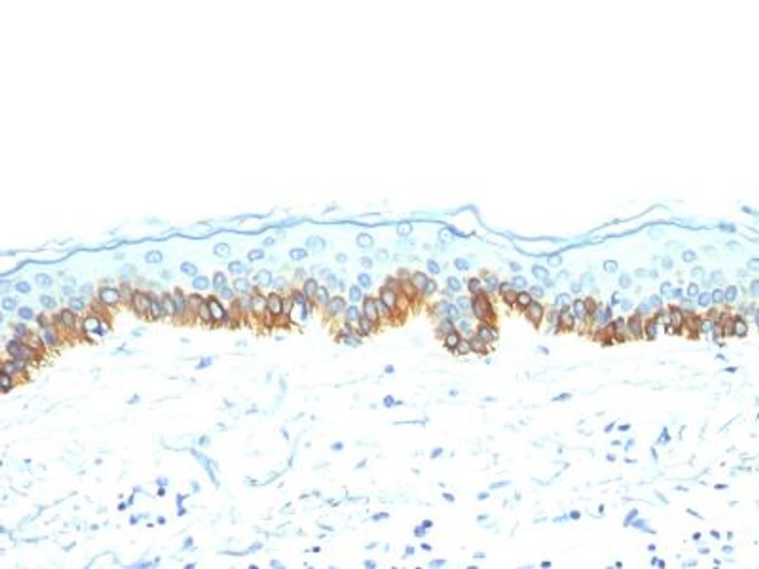 Immunohistochemistry-Paraffin: Cytokeratin, LMW Antibody (AE1) [NBP2-29411] - Formalin-fixed, paraffin-embedded skin stained with Cytokeratin, LMW Ab (AE1)