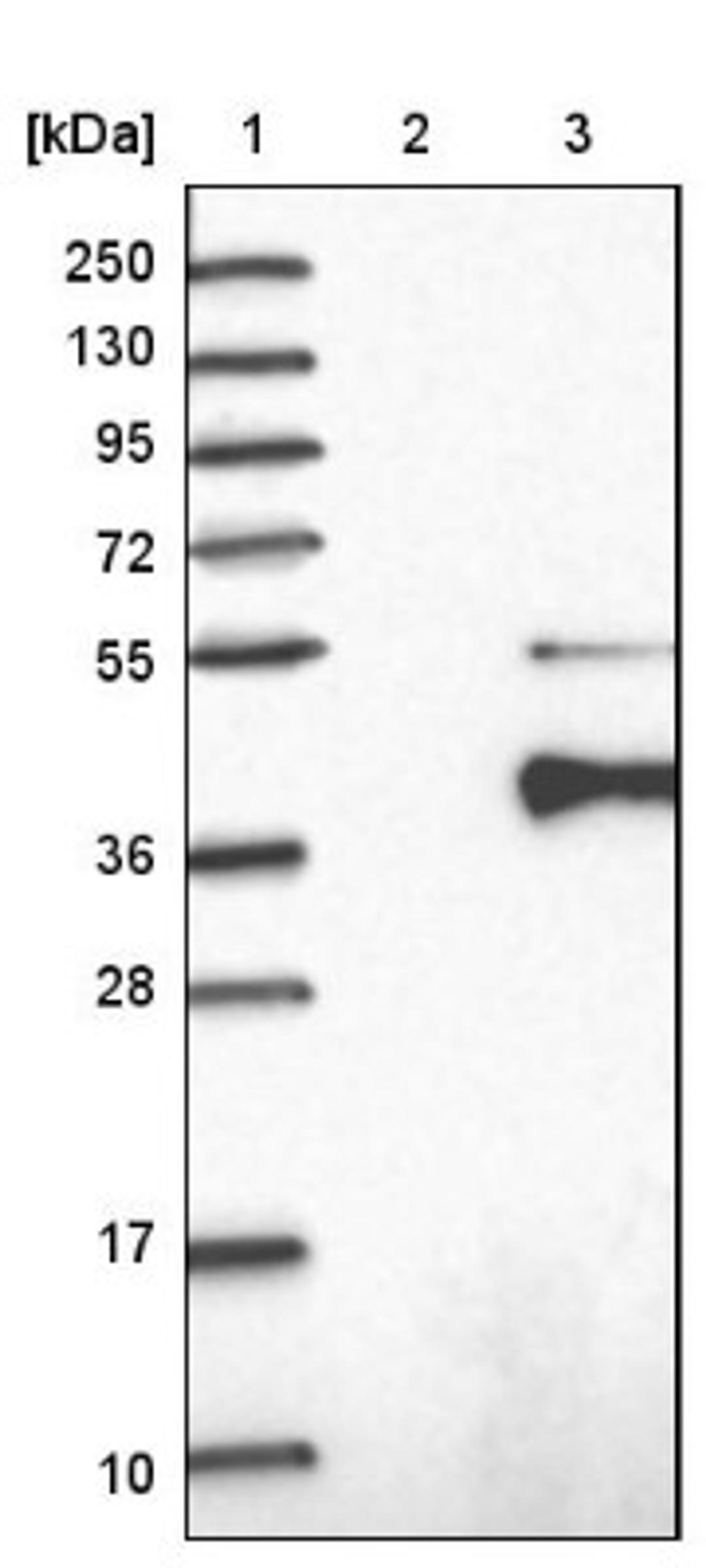 Western Blot: Cbx8 Antibody [NBP1-83224] - Lane 1: Marker [kDa] 250, 130, 95, 72, 55, 36, 28, 17, 10<br/>Lane 2: Negative control (vector only transfected HEK293T lysate)<br/>Lane 3: Over-expression lysate (Co-expressed with a C-terminal myc-DDK tag (~3.1 kDa) in mammalian HEK293T cells, LY412158)