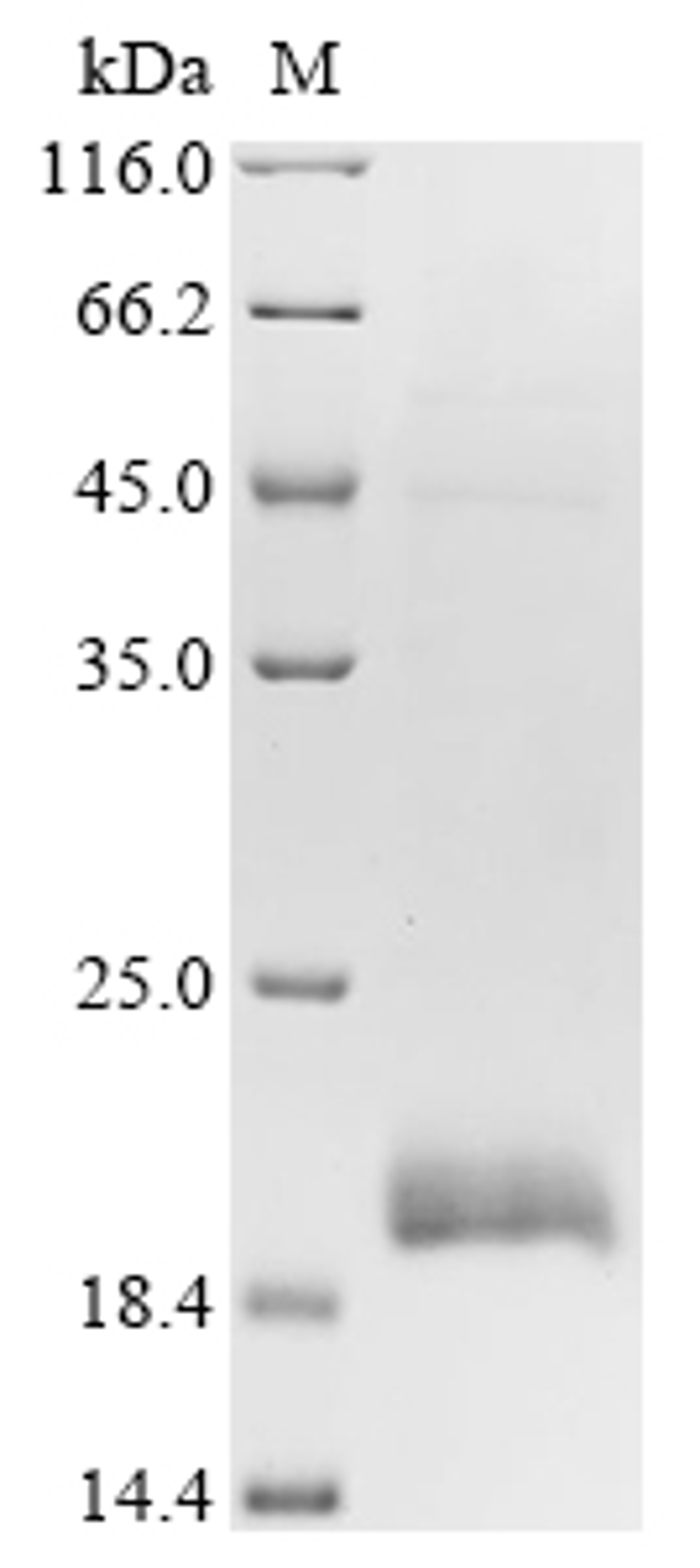 (Tris-Glycine gel) Discontinuous SDS-PAGE (reduced) with 5% enrichment gel and 15% separation gel.