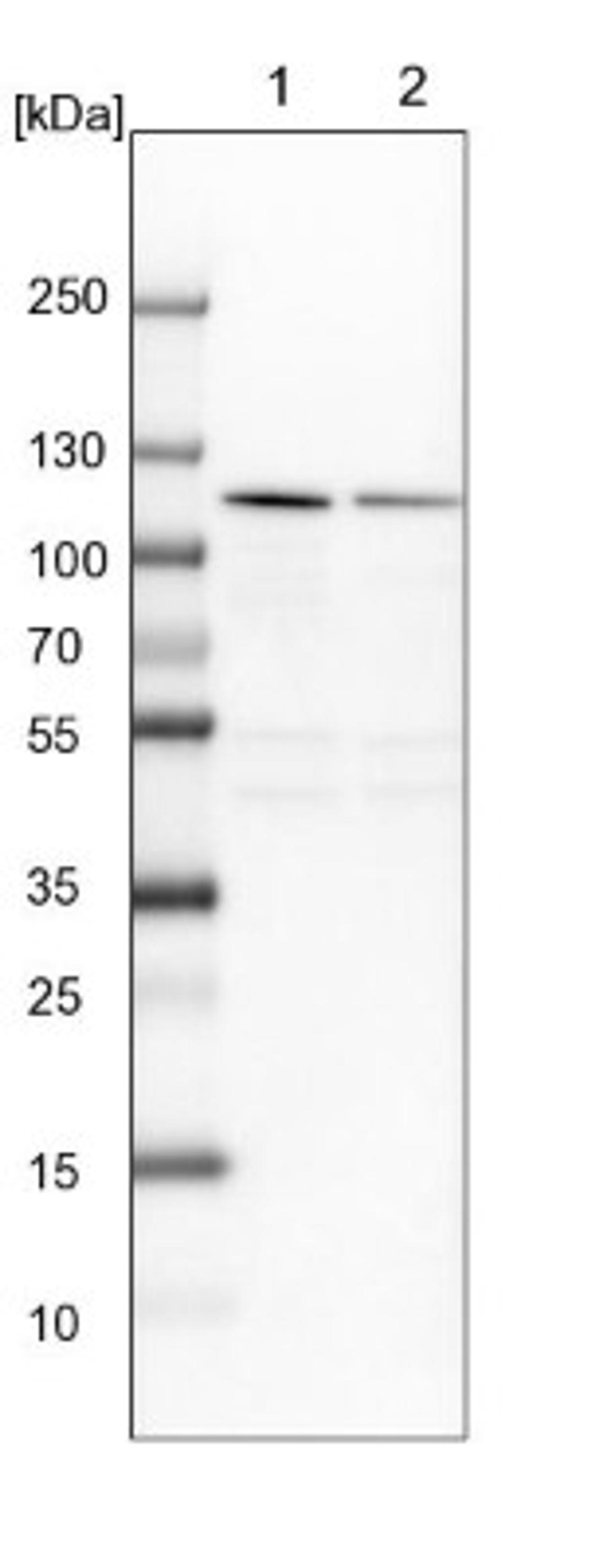 Western Blot: NOP14 Antibody [NBP2-13665] - Lane 1: NIH-3T3 cell lysate (Mouse embryonic fibroblast cells)<br/>Lane 2: NBT-II cell lysate (Rat Wistar bladder tumour cells)