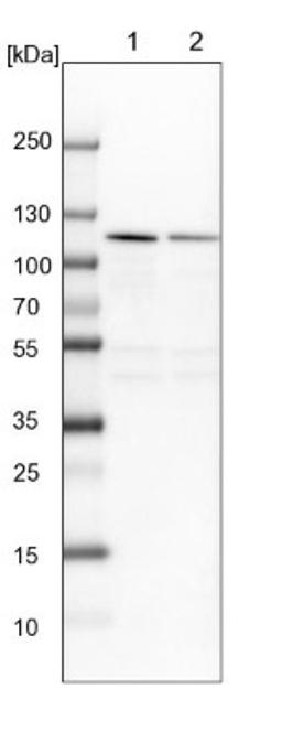 Western Blot: NOP14 Antibody [NBP2-13665] - Lane 1: NIH-3T3 cell lysate (Mouse embryonic fibroblast cells)<br/>Lane 2: NBT-II cell lysate (Rat Wistar bladder tumour cells)