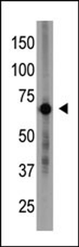 Antibody is used in Western blot to detect Cry1 in placenta tissue lysate.