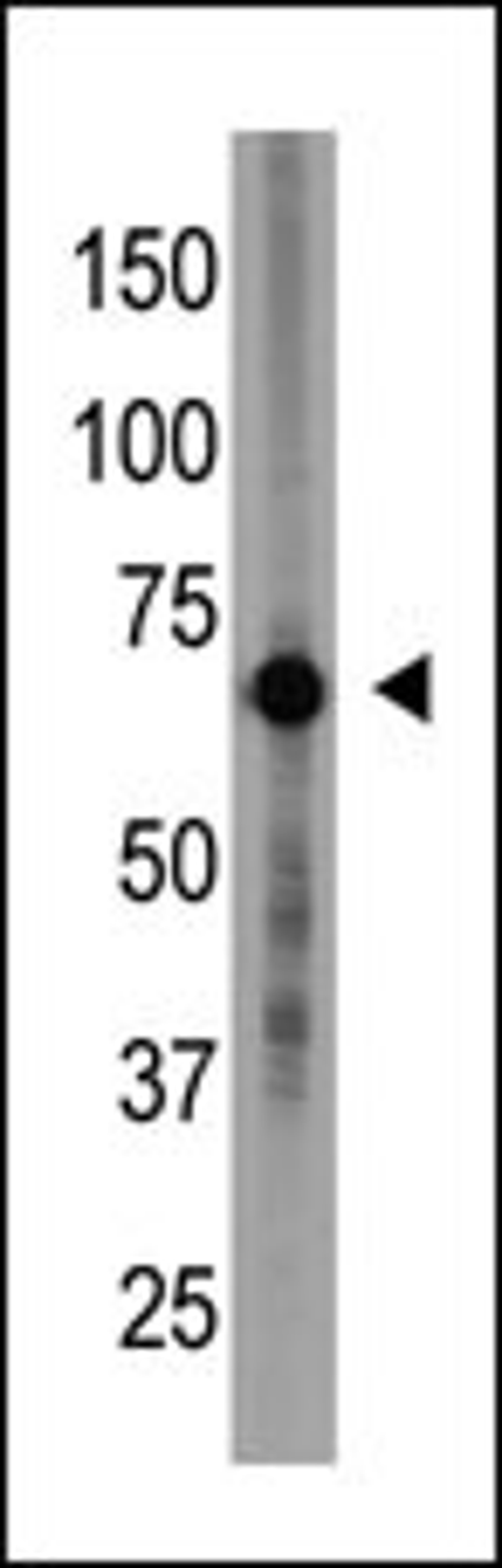 Antibody is used in Western blot to detect Cry1 in placenta tissue lysate.