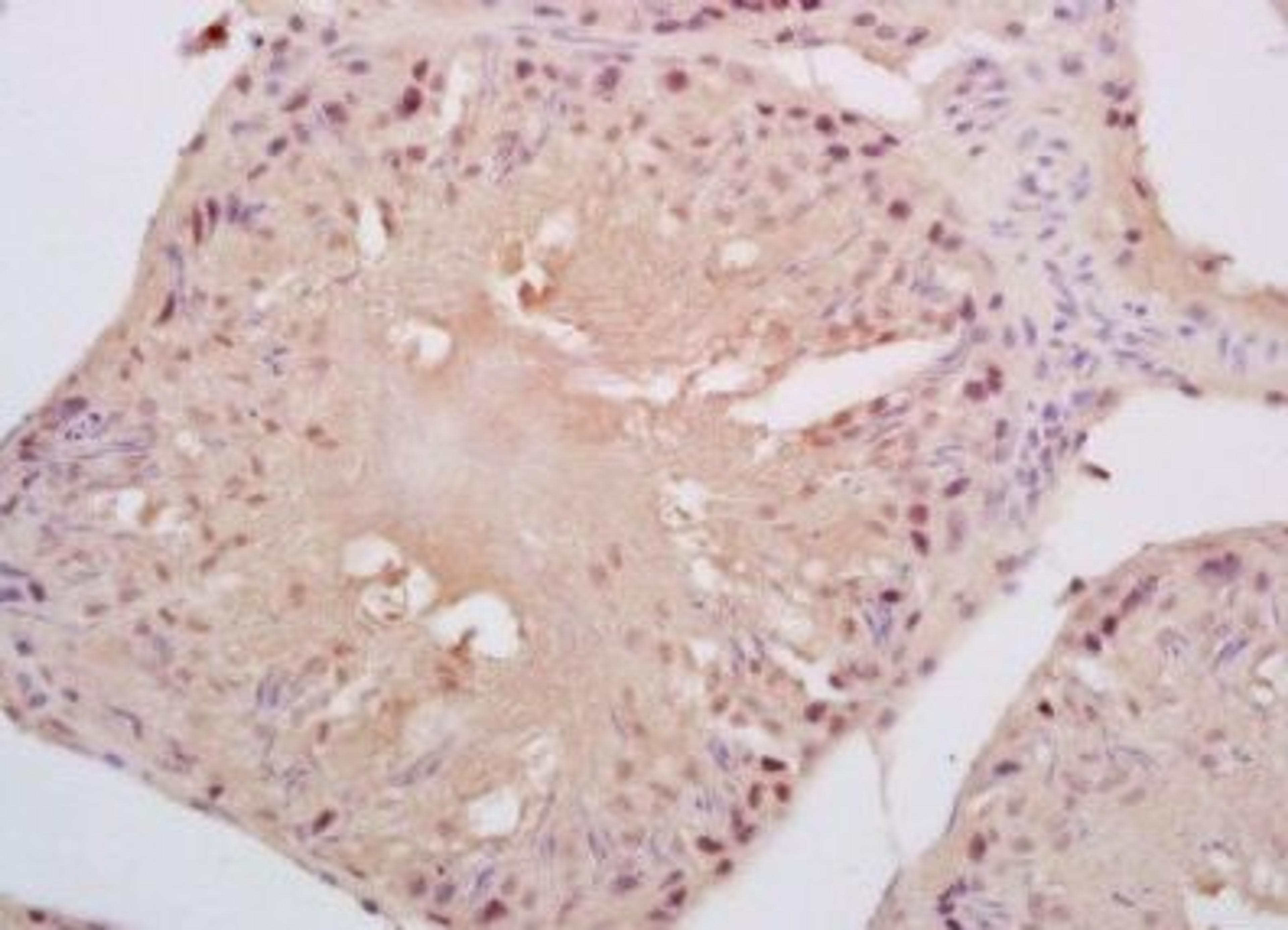 Immunohistochemical analysis of formalin-fixed paraffin embedded rat testis tissue using Cyclin B3 antibody (dilution at 1:200)