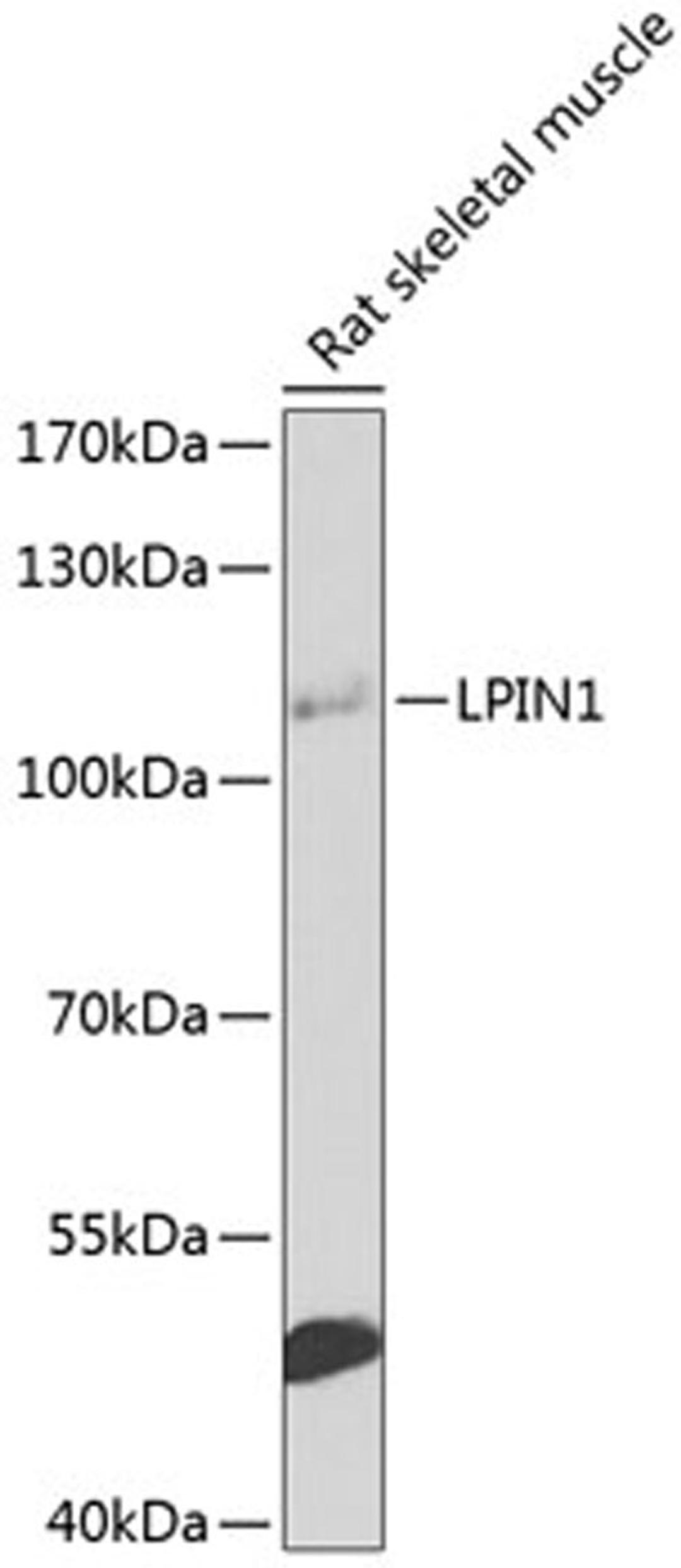 Western blot - LPIN1 antibody (A8486)