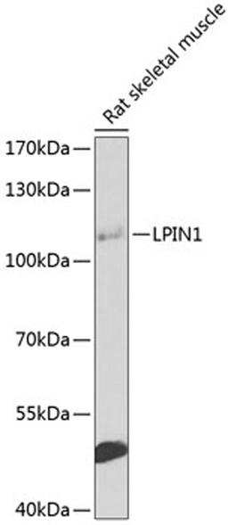 Western blot - LPIN1 antibody (A8486)