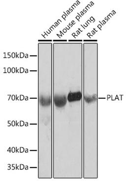 Western blot - PLAT Rabbit mAb (A4210)