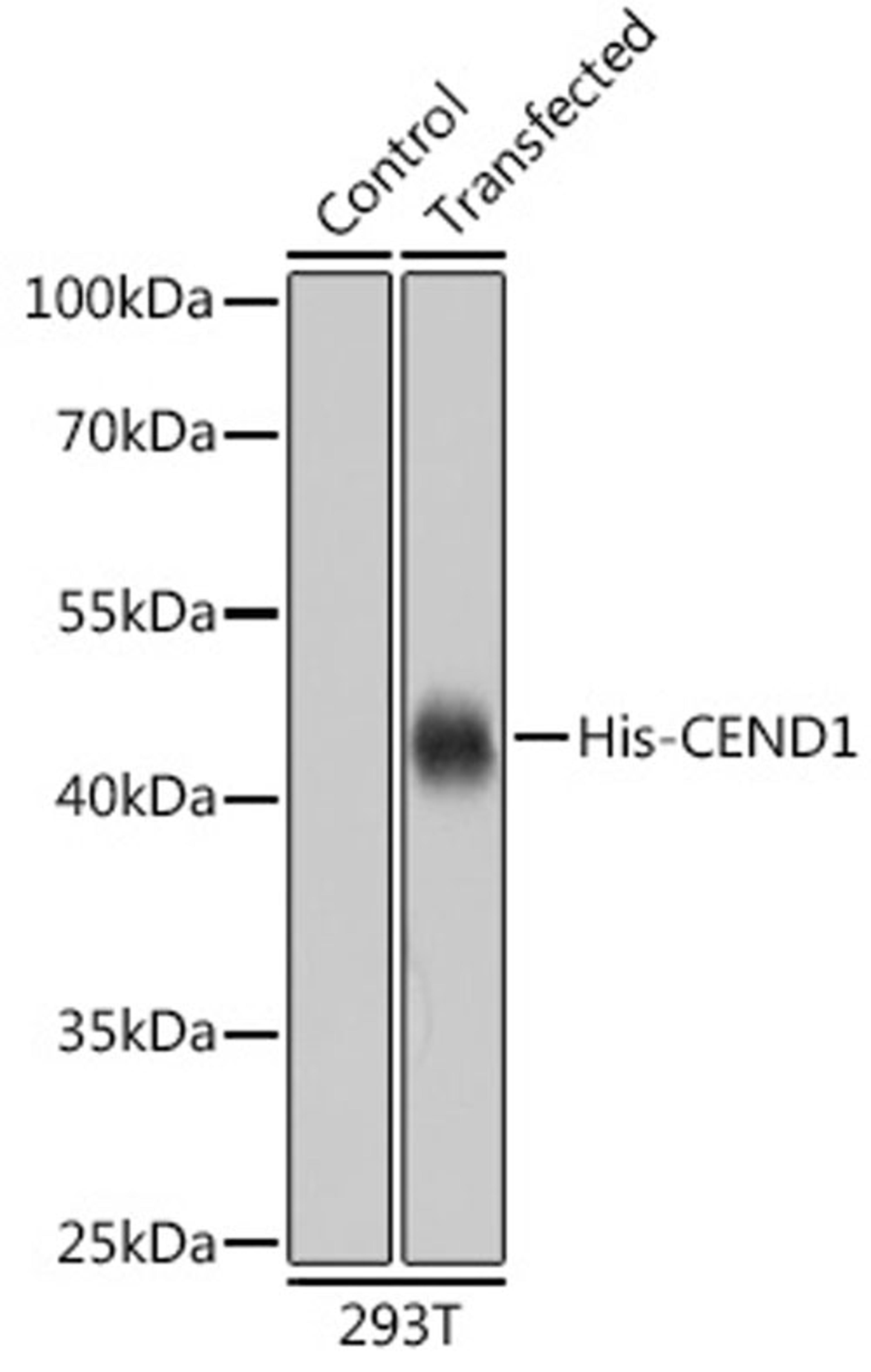 Immunofluorescence - Mouse anti His-Tag mAb (AE003)