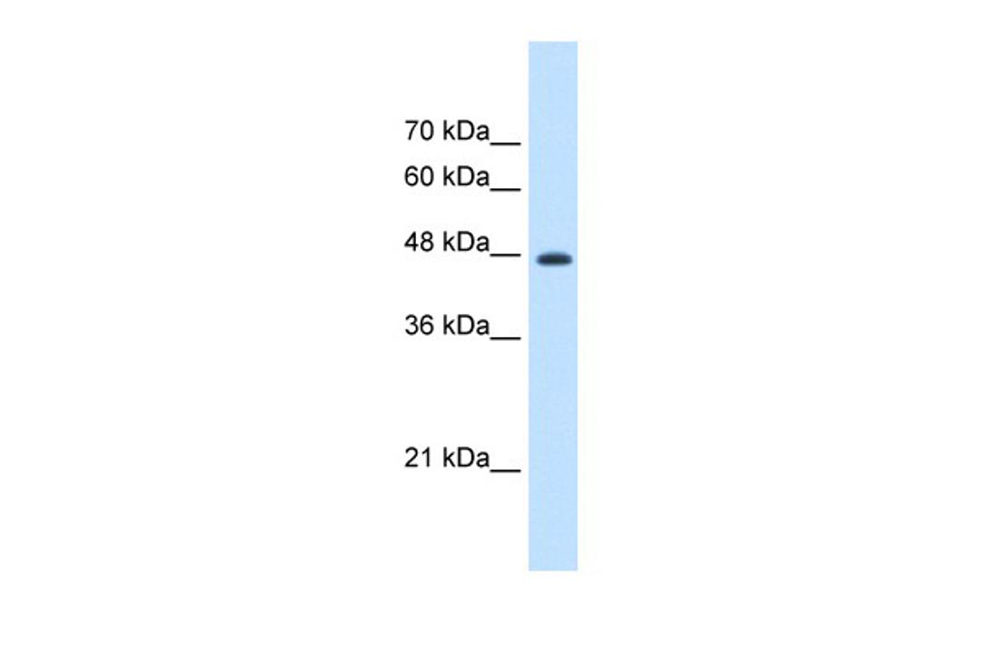 Antibody used in WB on Human HepG2 cells at 1.25 ug/ml.