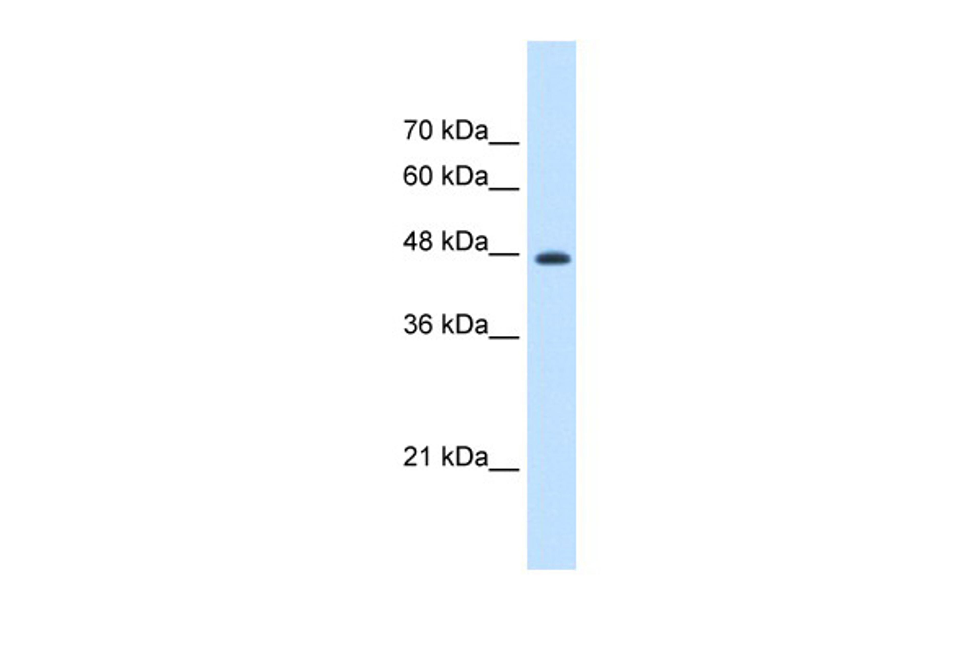 Antibody used in WB on Human HepG2 cells at 1.25 ug/ml.