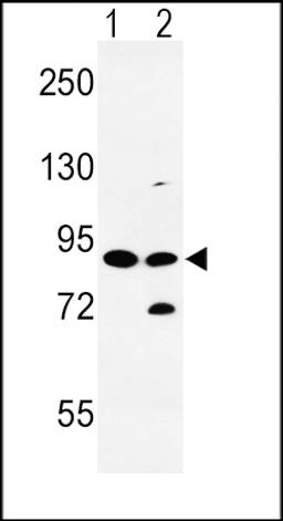 Western blot analysis of SLC8A1 Antibody in HL-60(lane 1), K562(lane 2) cell line lysates (35ug/lane)