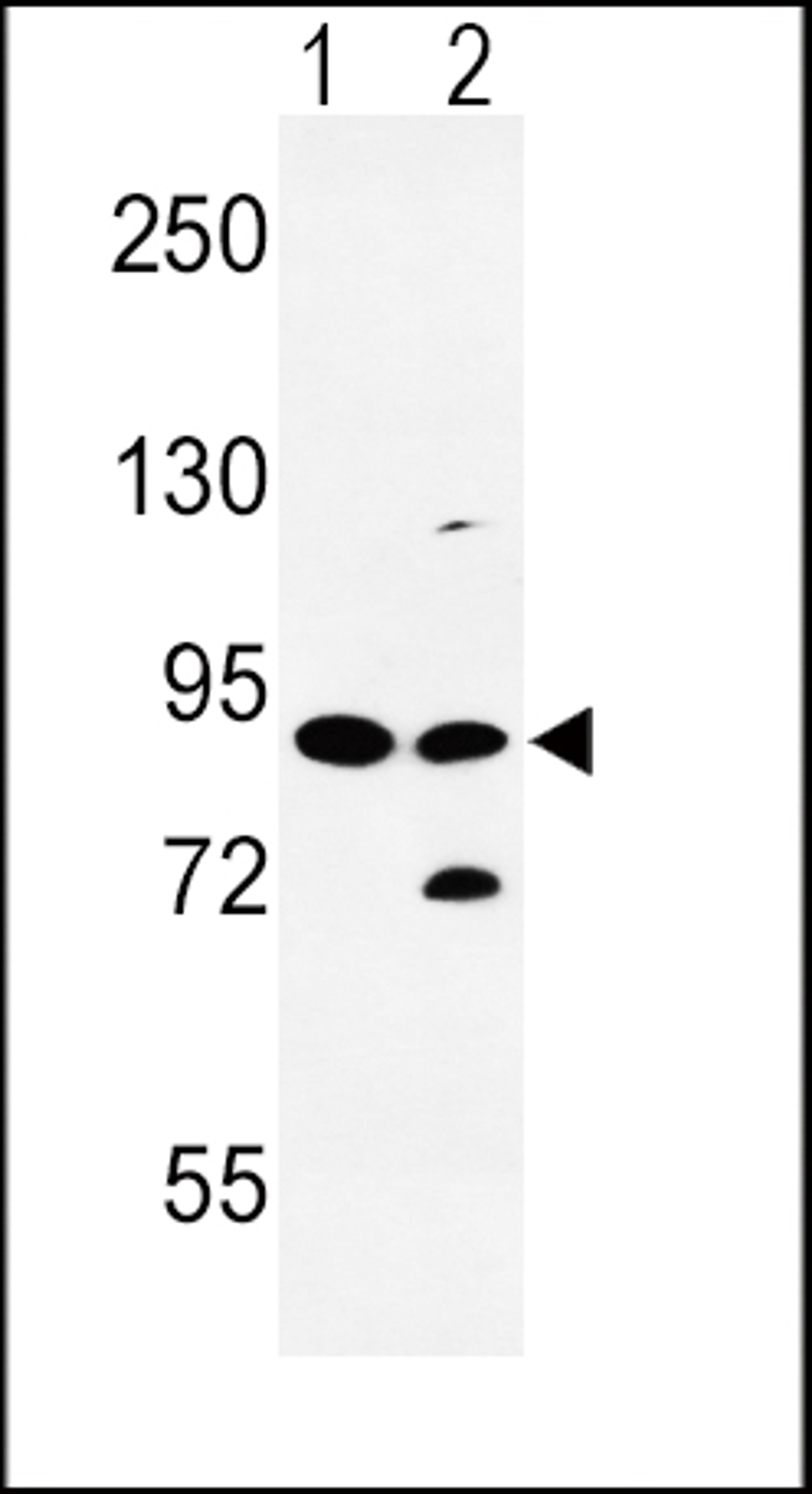 Western blot analysis of SLC8A1 Antibody in HL-60(lane 1), K562(lane 2) cell line lysates (35ug/lane)