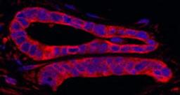 Detection of human SRPK2 by immunohistochemistry.