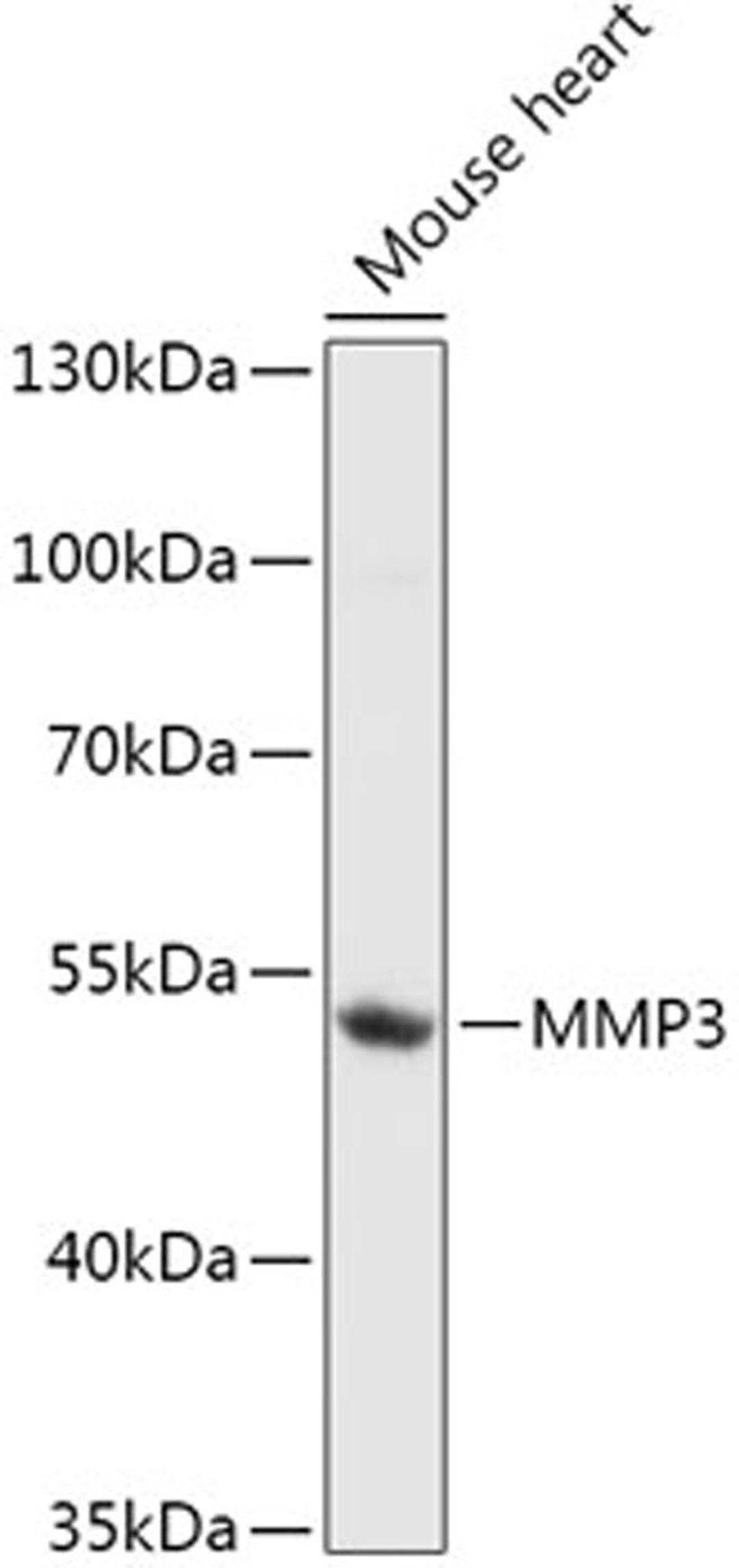 Western blot - MMP3 antibody (A1202)