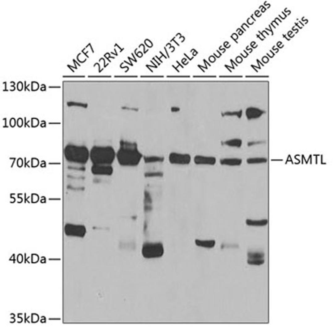 Western blot - ASMTL antibody (A7021)