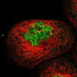 Immunocytochemistry/Immunofluorescence: DUSP19 Antibody [NBP1-84041] - Staining of human cell line A-431 shows positivity in nuclei but not nucleoli.