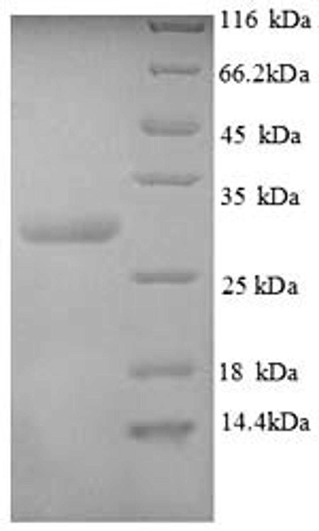 (Tris-Glycine gel) Discontinuous SDS-PAGE (reduced) with 5% enrichment gel and 15% separation gel.