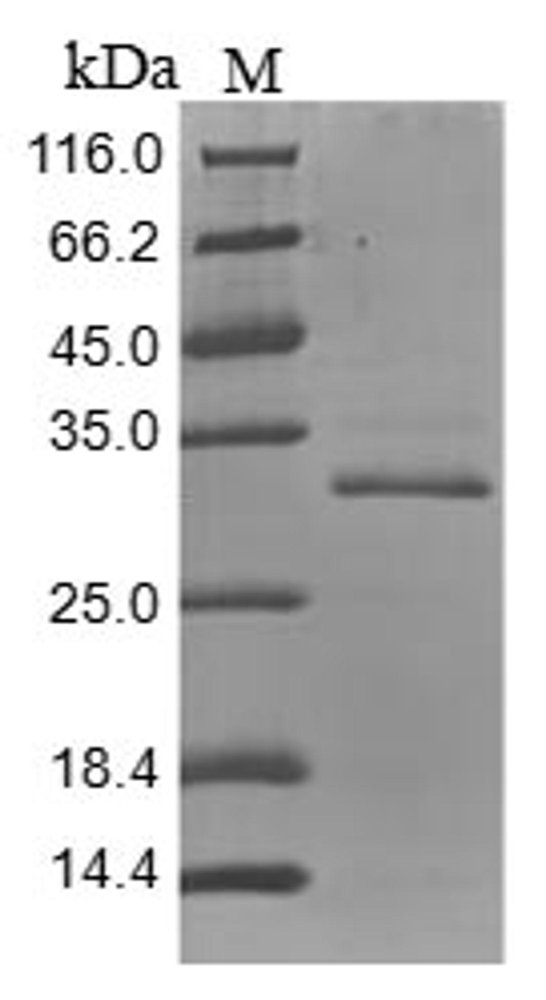 (Tris-Glycine gel) Discontinuous SDS-PAGE (reduced) with 5% enrichment gel and 15% separation gel.