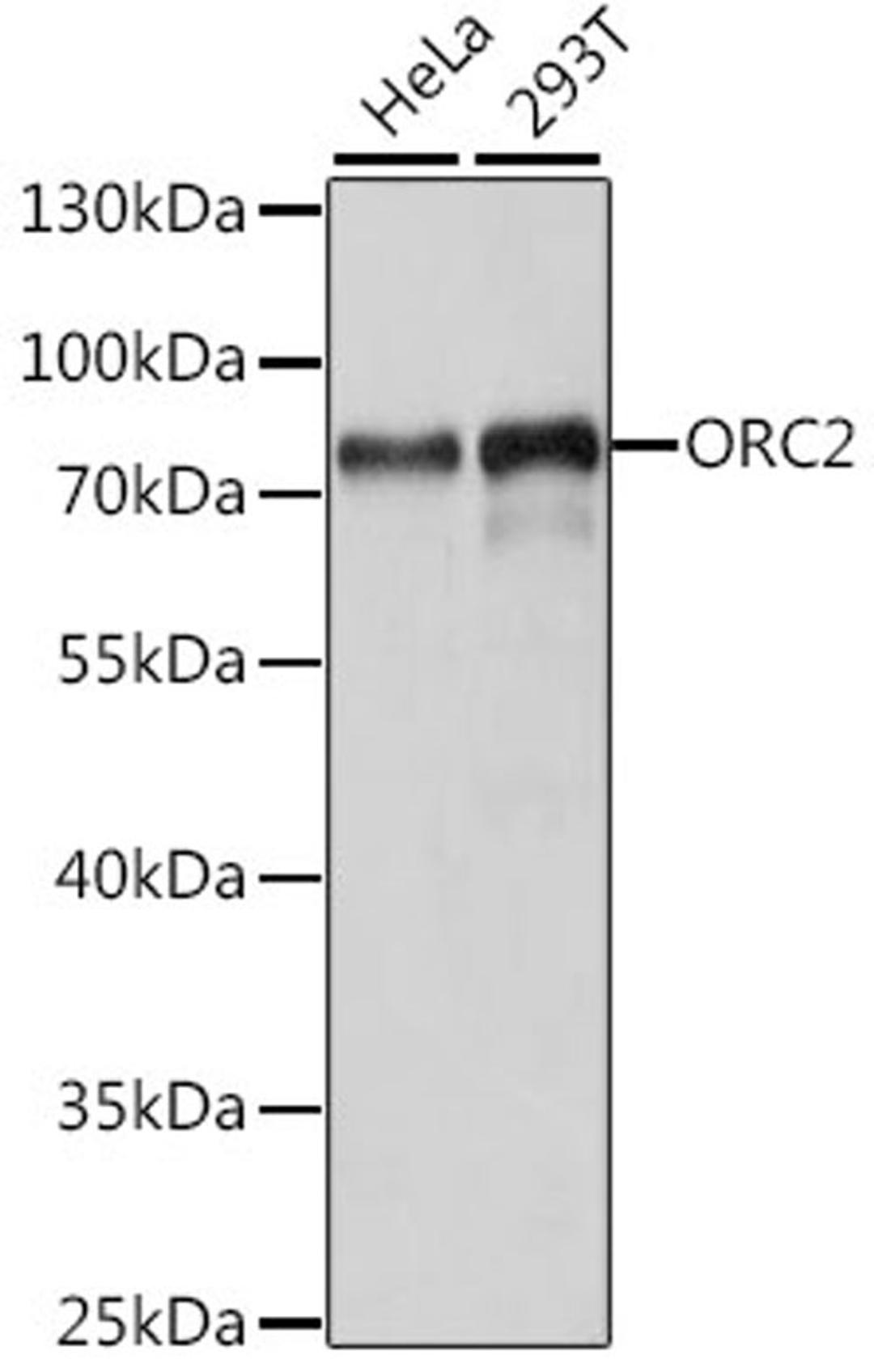 Western blot - ORC2 antibody (A15697)