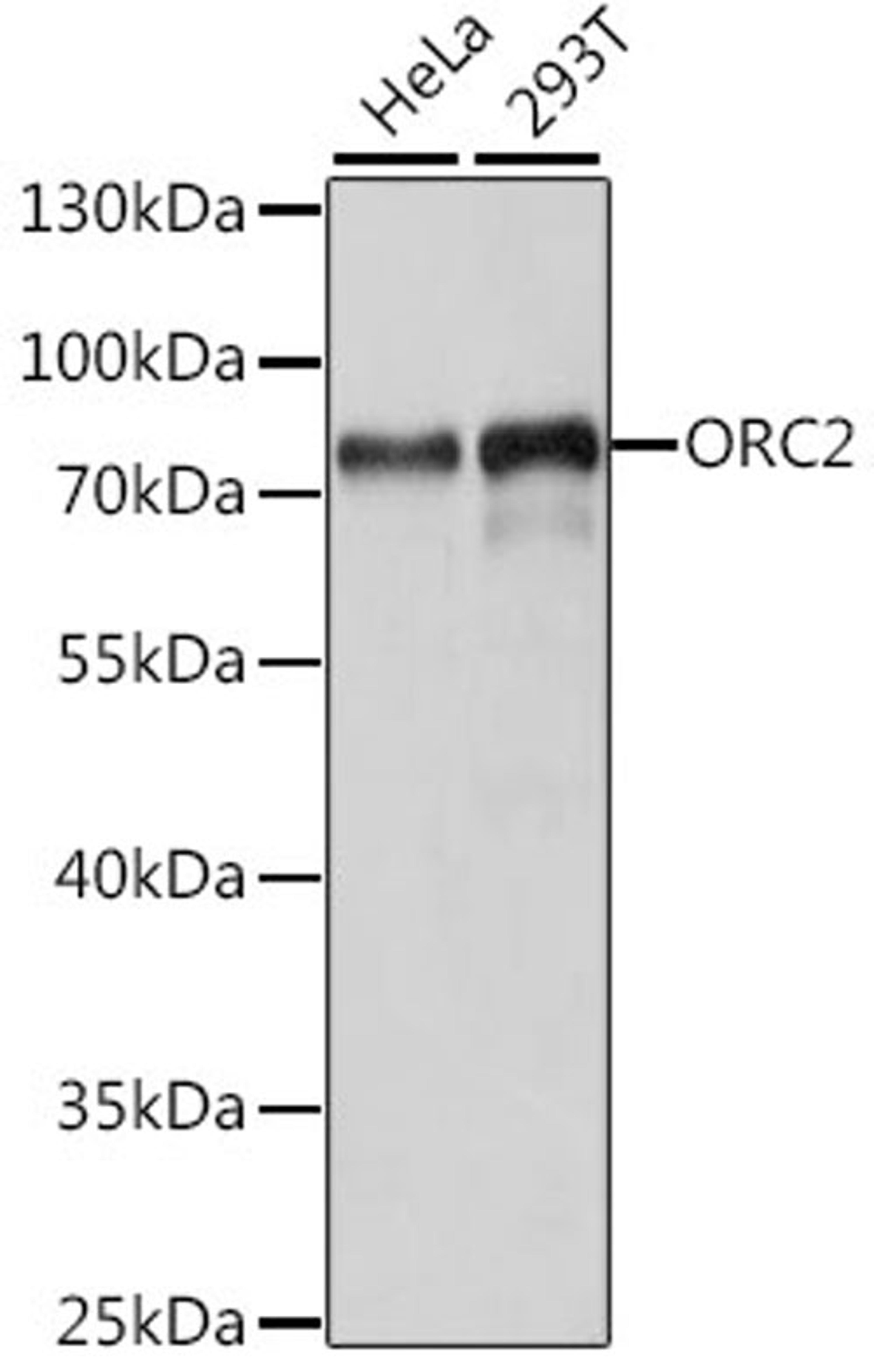 Western blot - ORC2 antibody (A15697)