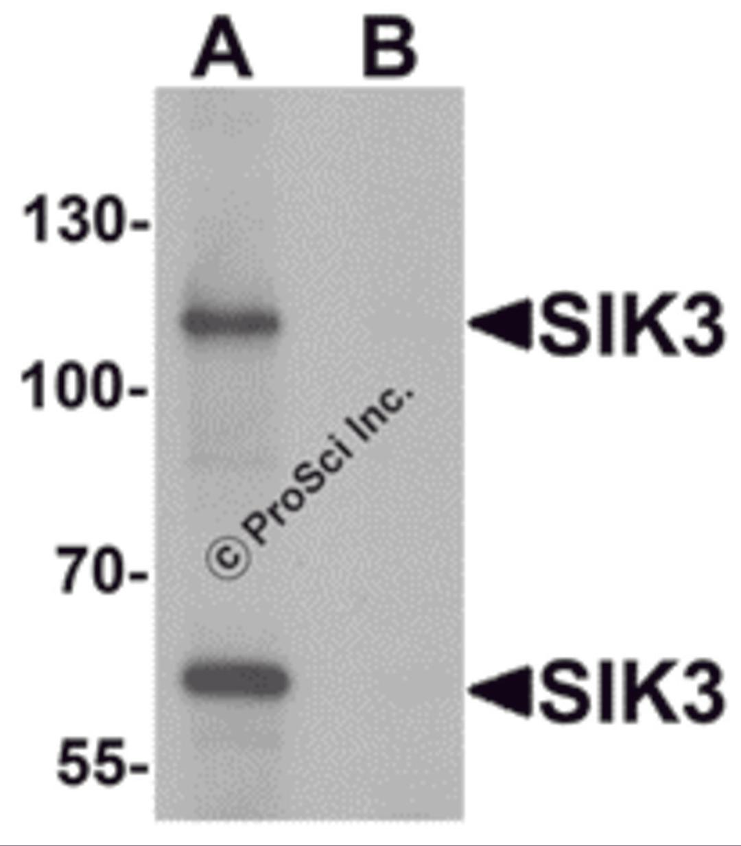 Western blot analysis of SIK3 in rat brain tissue lysate with SIK3 antibody at 1 &#956;g/mL in (A) the absence and (B) the presence of blocking peptide.