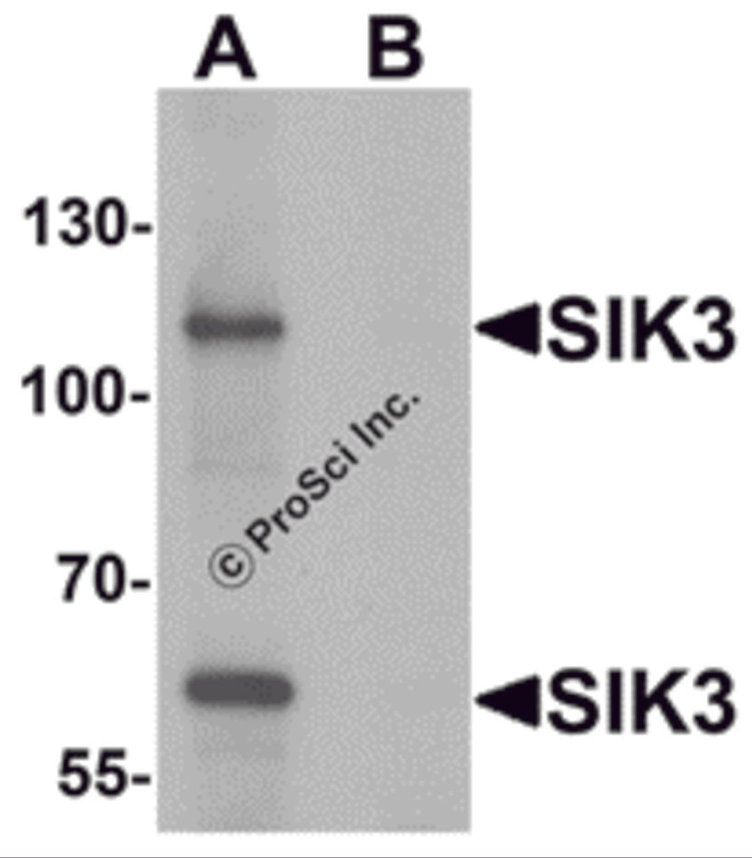 Western blot analysis of SIK3 in rat brain tissue lysate with SIK3 antibody at 1 μg/mL in (A) the absence and (B) the presence of blocking peptide.