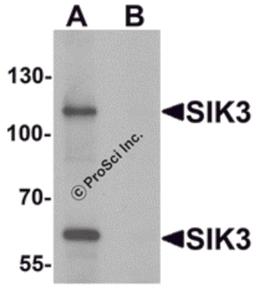 Western blot analysis of SIK3 in rat brain tissue lysate with SIK3 antibody at 1 μg/mL in (A) the absence and (B) the presence of blocking peptide.